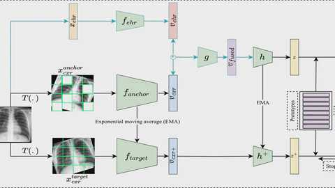 Multimodal masked siamese network improves chest X-ray representation learning