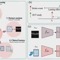 Multimodal Deep Learning for Stroke Prediction and Detection using Retinal Imaging and Clinical Data