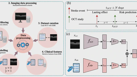 Multimodal Deep Learning for Stroke Prediction and Detection using Retinal Imaging and Clinical Data